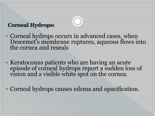  Corneal hydrops occurs in advanced cases, when
Descemet's membrane ruptures, aqueous flows into
the cornea and reseals
 Keratoconus patients who are having an acute
episode of corneal hydrops report a sudden loss of
vision and a visible white spot on the cornea.
 Corneal hydrops causes edema and opacification.
 