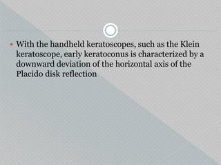  With the handheld keratoscopes, such as the Klein
keratoscope, early keratoconus is characterized by a
downward deviation of the horizontal axis of the
Placido disk reflection
 
