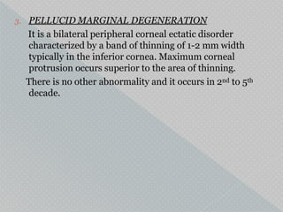 3. PELLUCID MARGINAL DEGENERATION
It is a bilateral peripheral corneal ectatic disorder
characterized by a band of thinning of 1-2 mm width
typically in the inferior cornea. Maximum corneal
protrusion occurs superior to the area of thinning.
There is no other abnormality and it occurs in 2nd to 5th
decade.
 