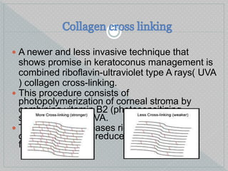 A newer and less invasive technique that
shows promise in keratoconus management is
combined riboflavin-ultraviolet type A rays( UVA
) collagen cross-linking.
 This procedure consists of
photopolymerization of corneal stroma by
combining vitamin B2 (photosensitizing
substance) with UVA.
 This process increases rigidity of corneal
collagen and thus reduces the likelihood of
further ectasia.
 