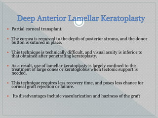 Partial corneal transplant.
 The cornea is removed to the depth of posterior stroma, and the donor
button is sutured in place.
 This technique is technically difficult, and visual acuity is inferior to
that obtained after penetrating keratoplasty.
 As a result, use of lamellar keratoplasty is largely confined to the
treatment of large cones or keratoglobus when tectonic support is
needed.
 This technique requires less recovery time, and poses less chance for
corneal graft rejection or failure.
 Its disadvantages include vascularization and haziness of the graft
 