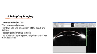 Pentacam(Oculus, Inc)
•Two integrated cameras:
–Central: size and orientation of the pupil, and
fixation
–Rotating Scheimpflug camera
• 50 Scheimpflug images during one scan in less
than 2 seconds
Scheimpflug imaging
 