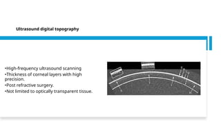 •High-frequency ultrasound scanning
•Thickness of corneal layers with high
precision.
•Post refractive surgery.
•Not limited to optically transparent tissue.
Ultrasound digital topography
 