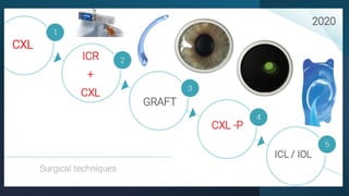 Diagnosis and management of Keratoconus cases