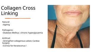 Collagen Cross
Linking
Natural:
–Ageing
Pathogenic:
–Diabetes Mellitus –chronic hyperglycaemia
Artificial:
–Strengthen collagenous valves: Cardiac
Surgery
–Cornea for Keratoconus !
 