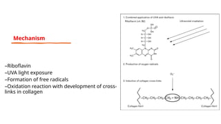 –Riboflavin
–UVA light exposure
–Formation of free radicals
–Oxidation reaction with development of cross-
links in collagen
Mechanism
 
