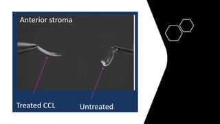 Diagnosis and management of Keratoconus cases