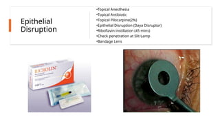 Epithelial
Disruption
•Topical Anesthesia
•Topical Antibiotic
•Topical Pilocarpine(2%)
•Epithelial Disruption (Daya Disruptor)
•Riboflavin instillation (45 mins)
•Check penetration at Slit Lamp
•Bandage Lens
 