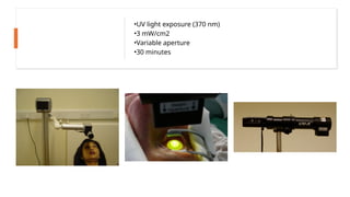 •UV light exposure (370 nm)
•3 mW/cm2
•Variable aperture
•30 minutes
 