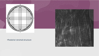 •Posterior stromal structure
 