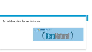 Corneal Allografts to Reshape the Cornea
 