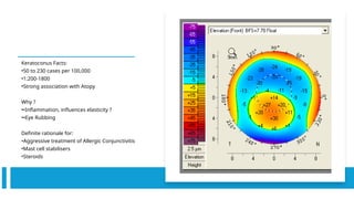 Keratoconus Facts:
•50 to 230 cases per 100,000
•1:200-1800
•Strong association with Atopy
Why ?
••Inflammation, influences elasticity ?
••Eye Rubbing
Definite rationale for:
•Aggressive treatment of Allergic Conjunctivitis
•Mast cell stabilisers
•Steroids
 