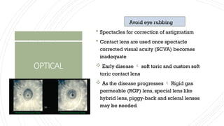 Piggyback Rgp KERATOCONUS- CLINICAL TOPIC PRESENTATION | PPTX