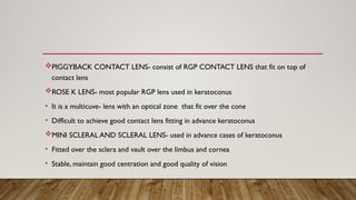 Piggyback Rgp Comprehensive Overview of Keratoconus: Diagnosis, Pathogenesis, and ...