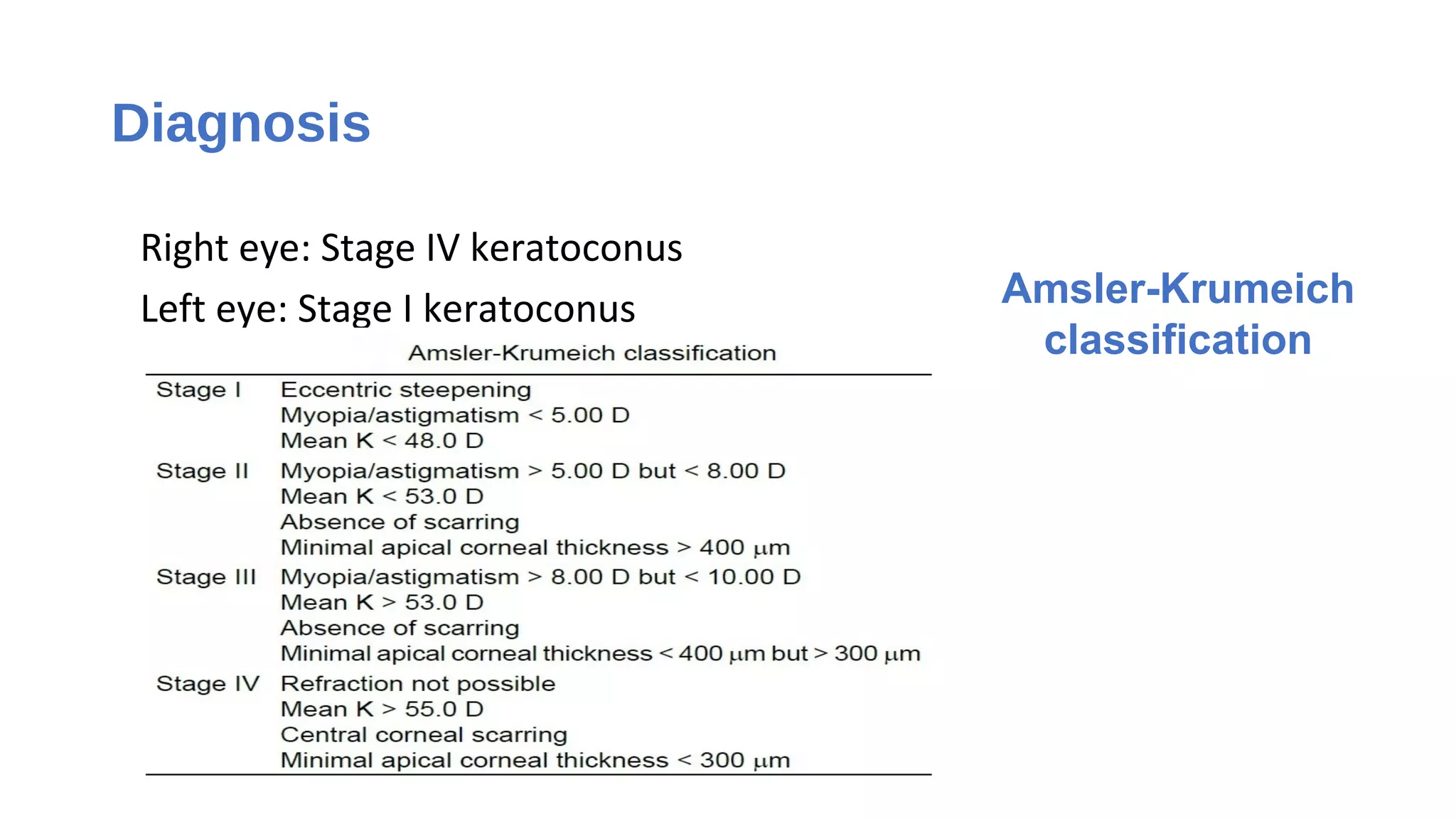 Diagnosis
Right eye: Stage IV keratoconus
Left eye: Stage I keratoconus Amsler-Krumeich
classification
 