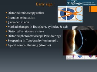 Early sign :
Distorted retinoscopy reflex
Irregular astigmatism
↓ unaided vision
Marked changes in Rx sphere, cylinder, & axis
Distorted keratometry mires
Distorted photokeratoscope Placido rings
Steepening in Topography/tomography
Apical corneal thinning (stromal)
 