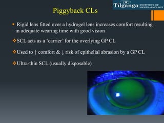 Piggyback CLs
 Rigid lens fitted over a hydrogel lens increases comfort resulting
in adequate wearing time with good vision
SCL acts as a ‘carrier’ for the overlying GP CL
Used to ↑ comfort & ↓ risk of epithelial abrasion by a GP CL
Ultra-thin SCL (usually disposable)
 
