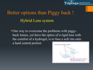 Better options than Piggy back !
One way to overcome the problems with piggy-
back lenses, yet have the optics of a rigid lens with
the comfort of a hydrogel, is to fuse a soft rim onto
a hard central portion
Hybrid Lens system
 