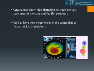 Keratoconus show high flattening between the very
steep apex of the cone and the flat periphery.
Need to have very steep lenses in the center that get
flatter quickly at periphery.
 
