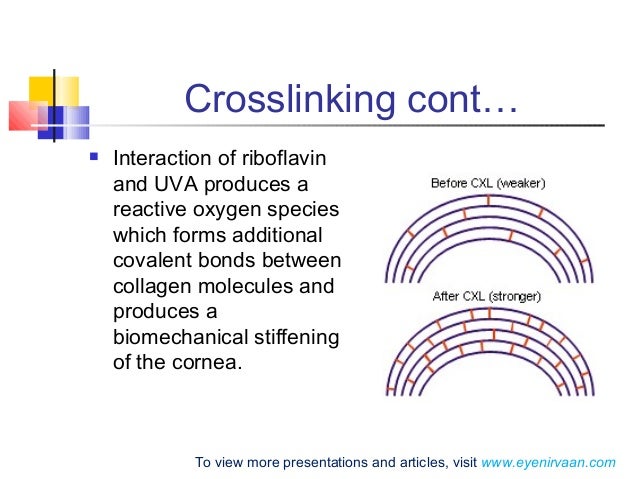 Keratoconus and collagen cross linking- Basic 