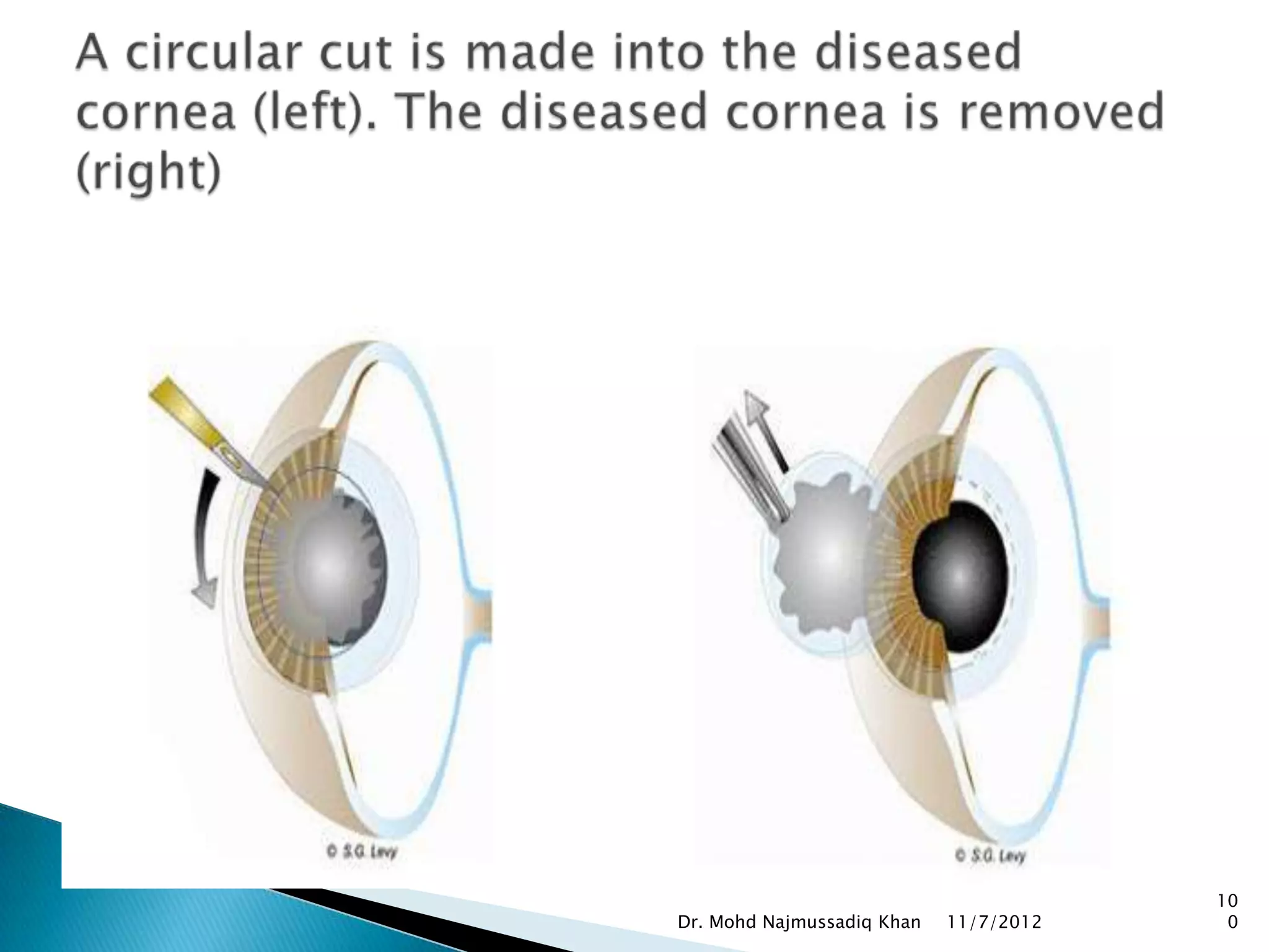 10
Dr. Mohd Najmussadiq Khan   11/7/2012    0
 