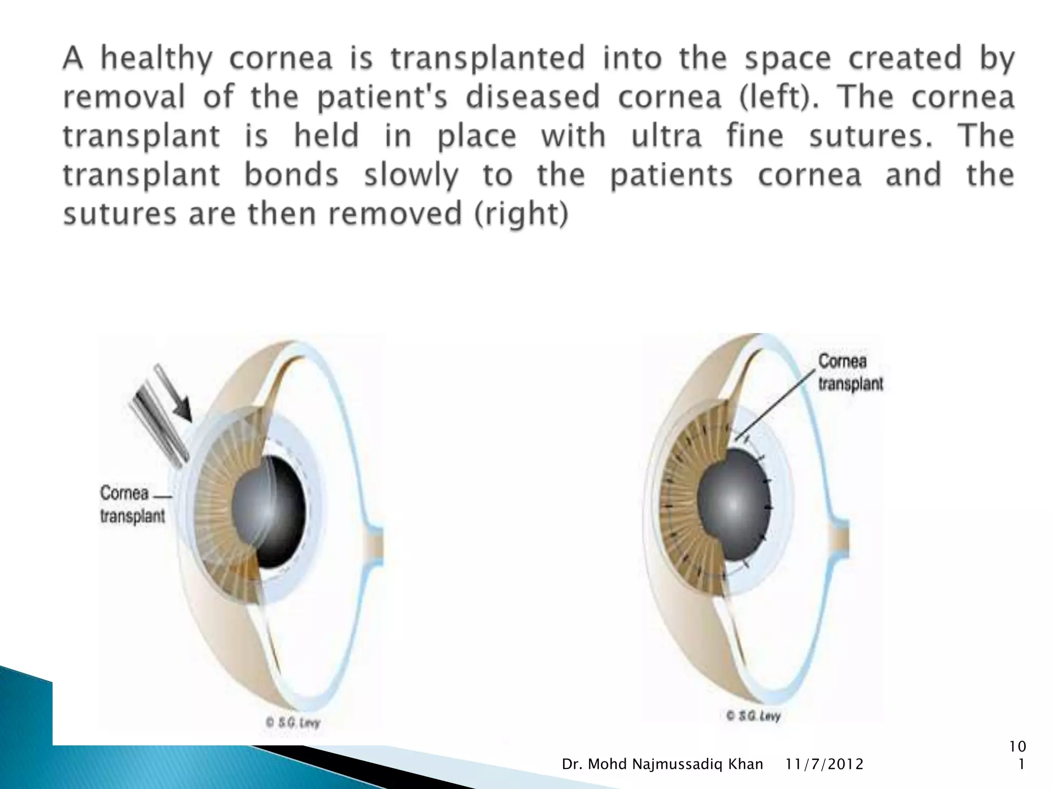 10
Dr. Mohd Najmussadiq Khan   11/7/2012    1
 