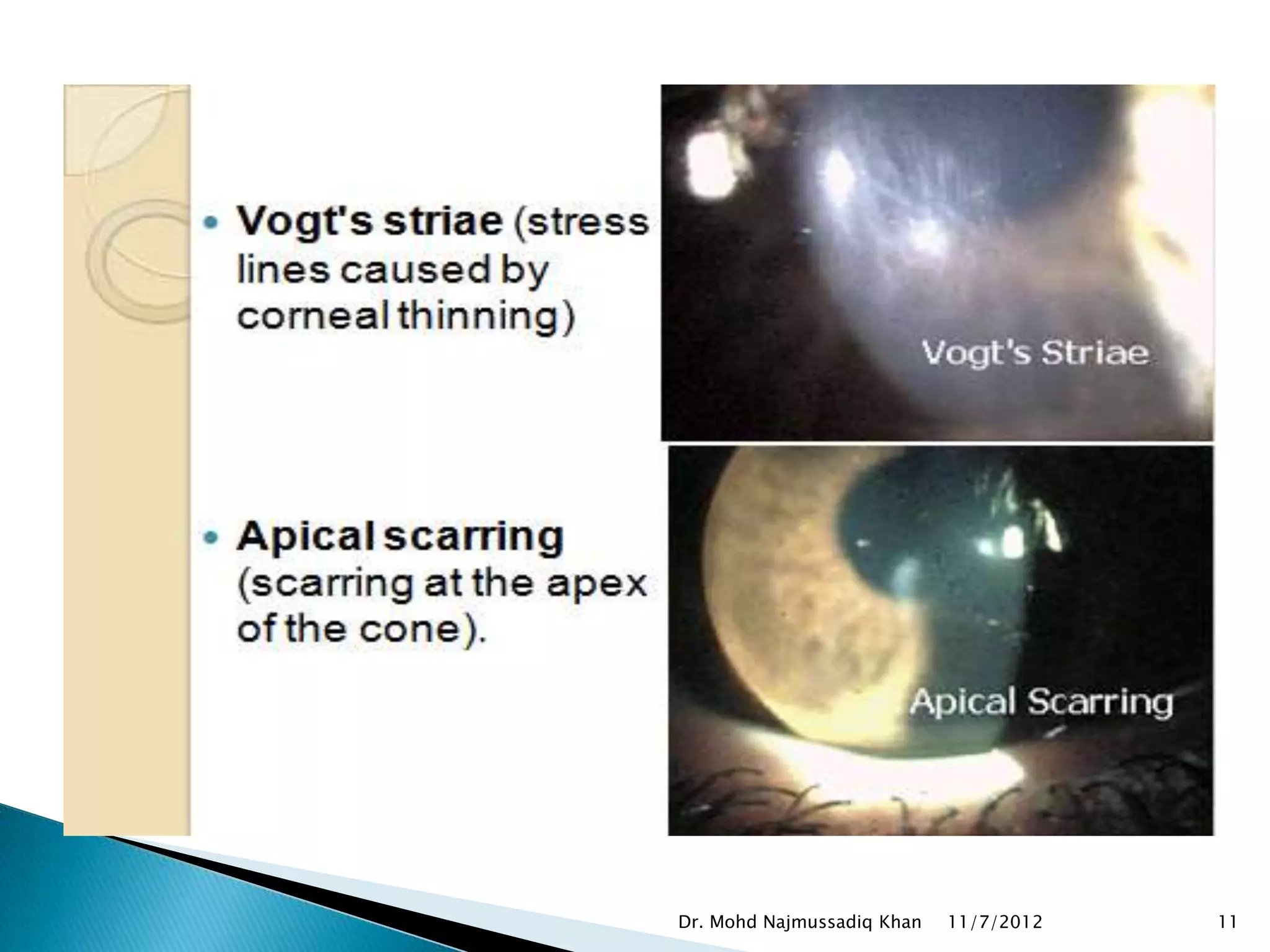 Dr. Mohd Najmussadiq Khan   11/7/2012   11
 