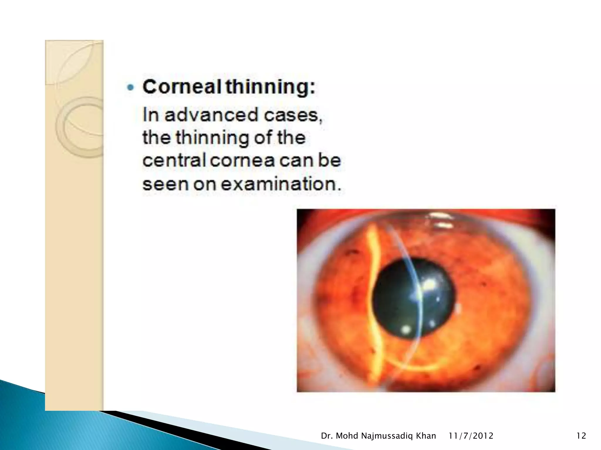 Dr. Mohd Najmussadiq Khan   11/7/2012   12
 