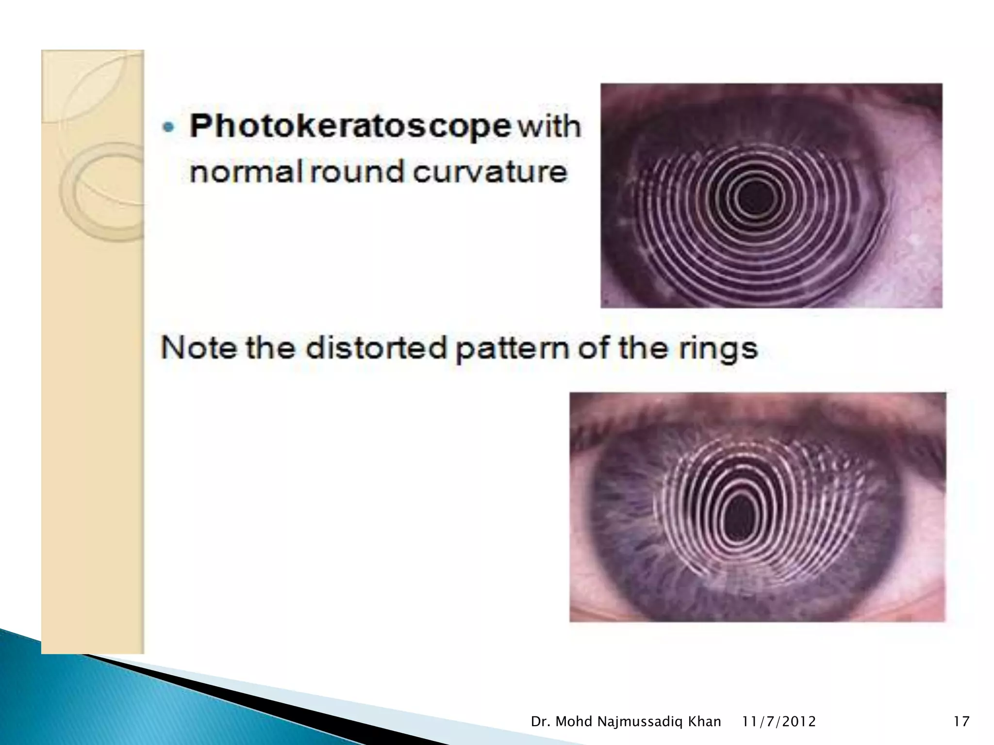 Dr. Mohd Najmussadiq Khan   11/7/2012   17
 