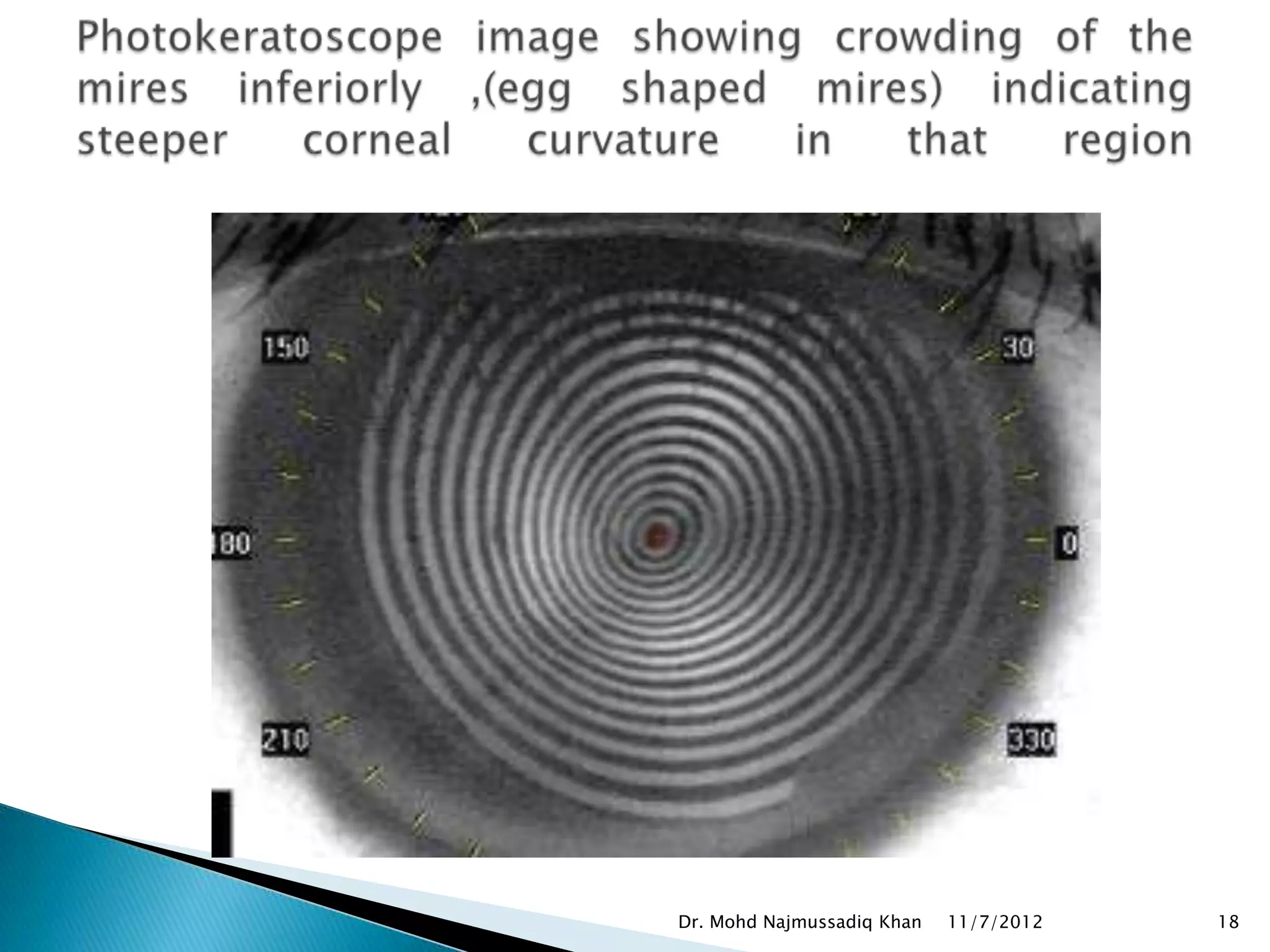 Dr. Mohd Najmussadiq Khan   11/7/2012   18
 