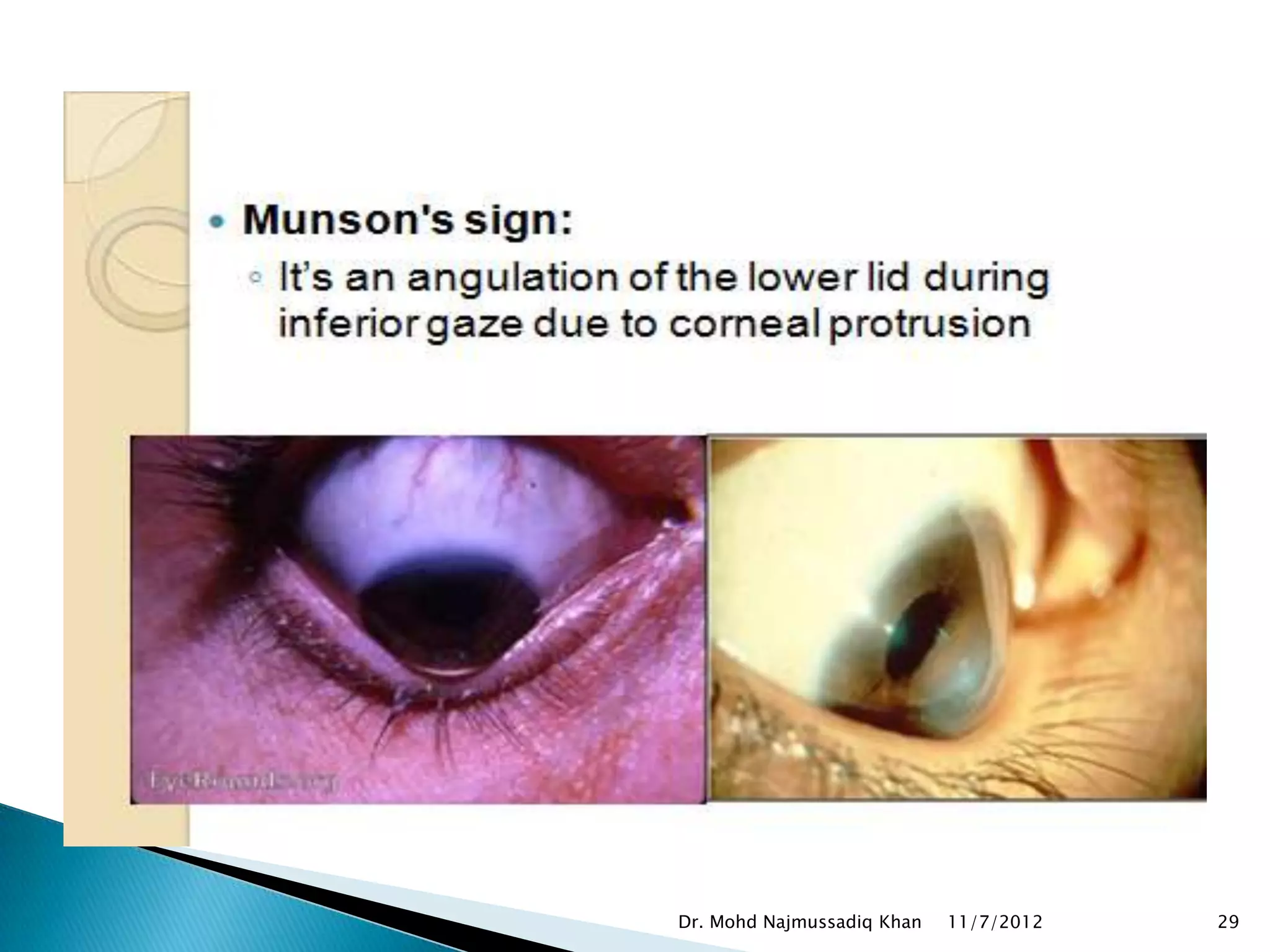 Dr. Mohd Najmussadiq Khan   11/7/2012   29
 