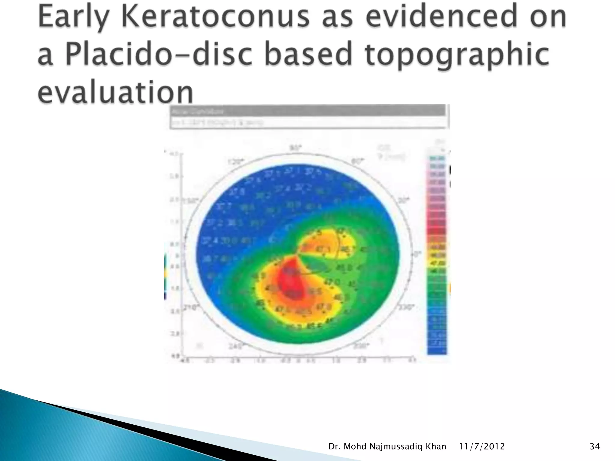 Dr. Mohd Najmussadiq Khan   11/7/2012   34
 