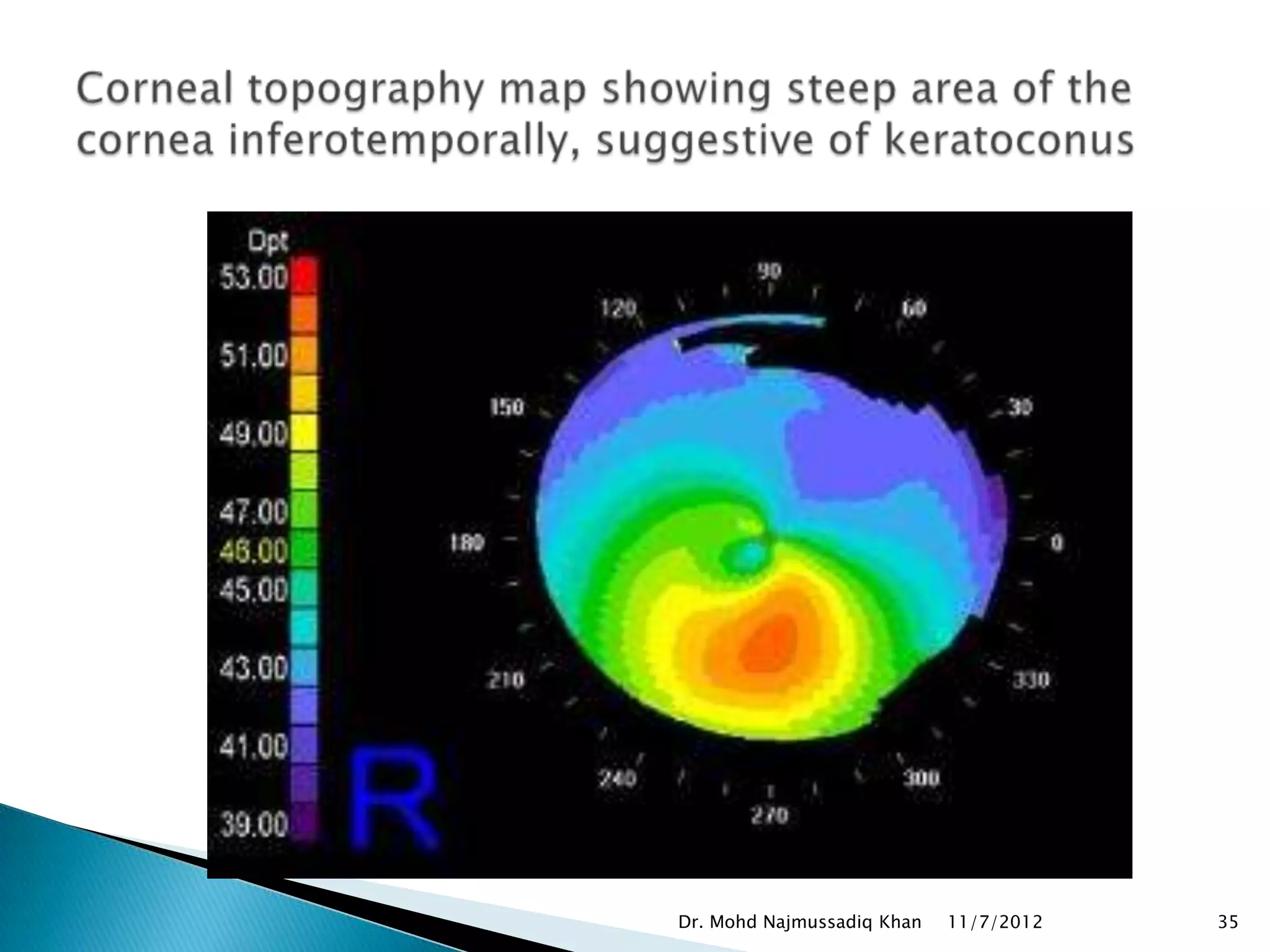 Dr. Mohd Najmussadiq Khan   11/7/2012   35
 