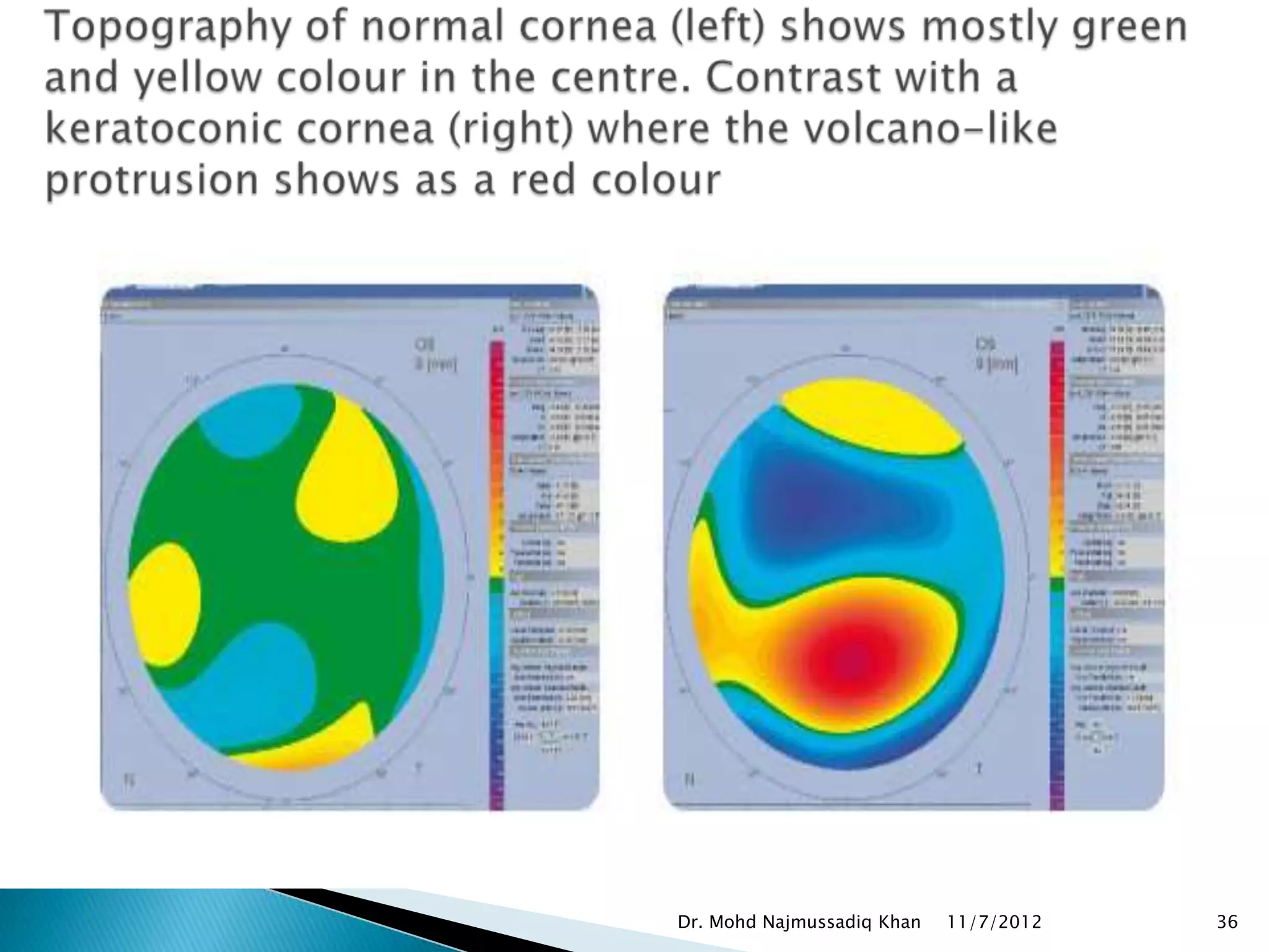 Dr. Mohd Najmussadiq Khan   11/7/2012   36
 