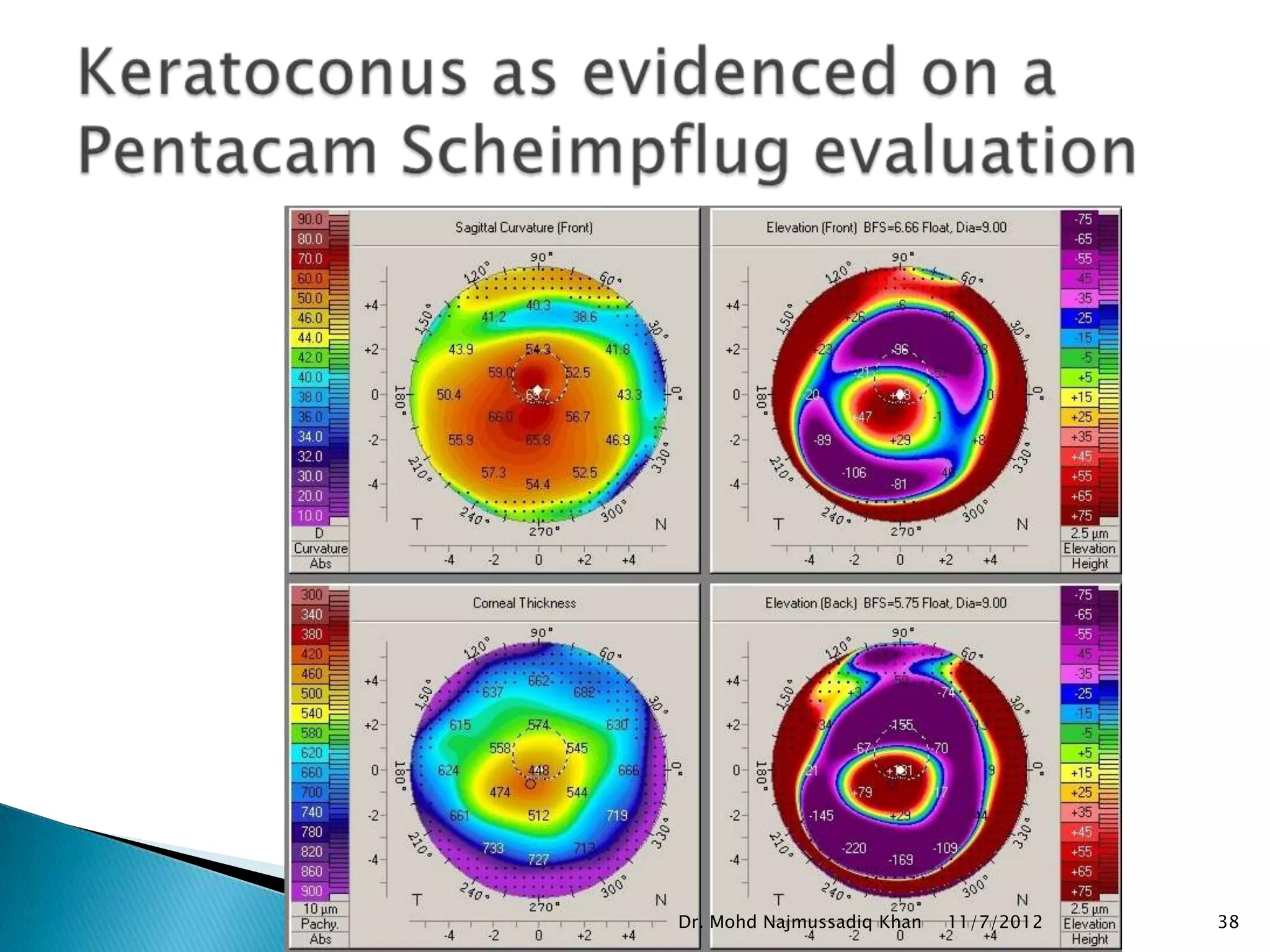 Dr. Mohd Najmussadiq Khan   11/7/2012   38
 