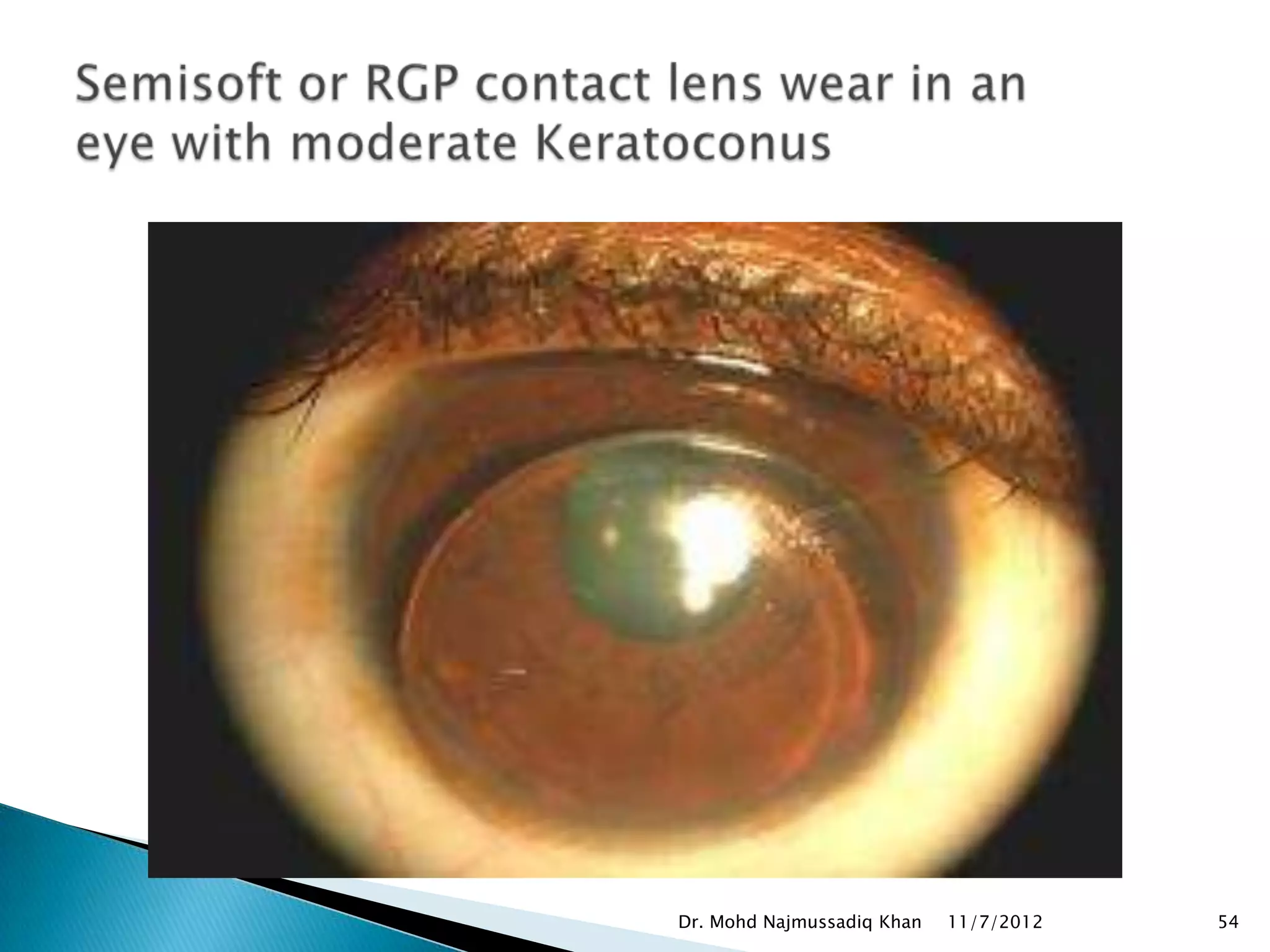 Dr. Mohd Najmussadiq Khan   11/7/2012   54
 