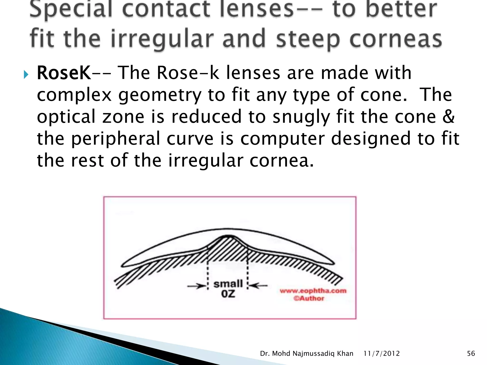    RoseK-- The Rose-k lenses are made with
    complex geometry to fit any type of cone. The
    optical zone is reduced to snugly fit the cone &
    the peripheral curve is computer designed to fit
    the rest of the irregular cornea.




                             Dr. Mohd Najmussadiq Khan   11/7/2012   56
 