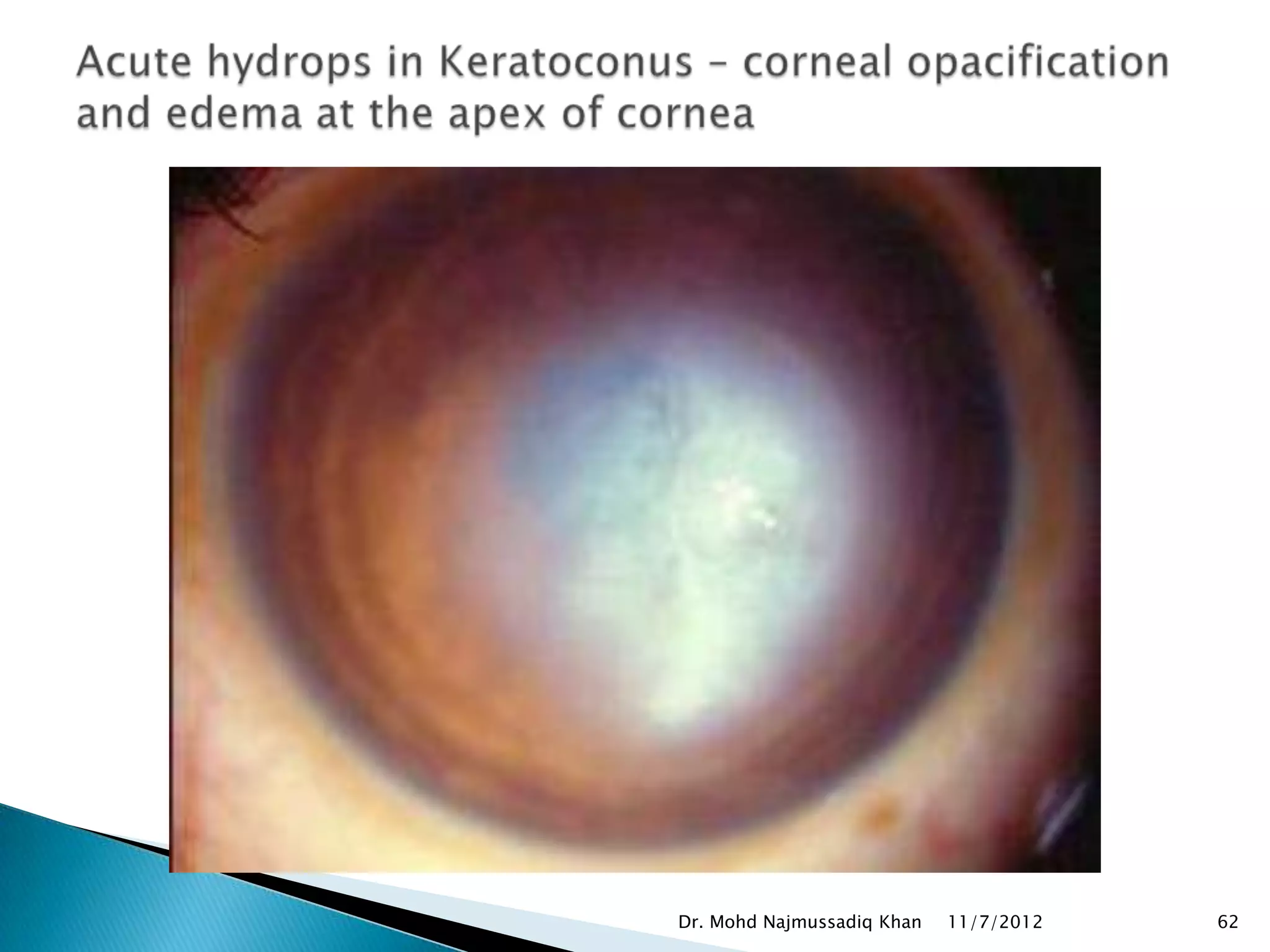 Dr. Mohd Najmussadiq Khan   11/7/2012   62
 