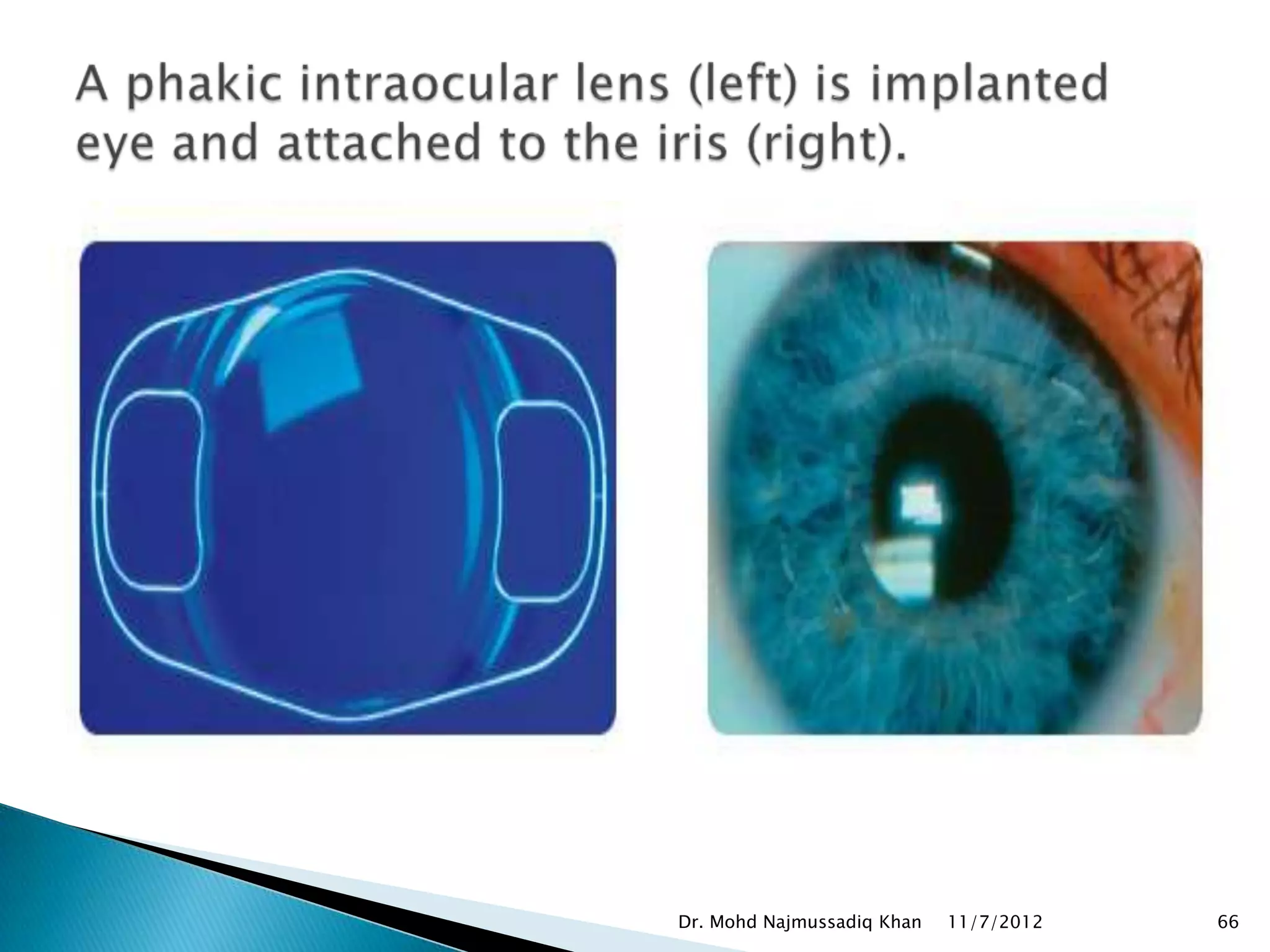 Dr. Mohd Najmussadiq Khan   11/7/2012   66
 