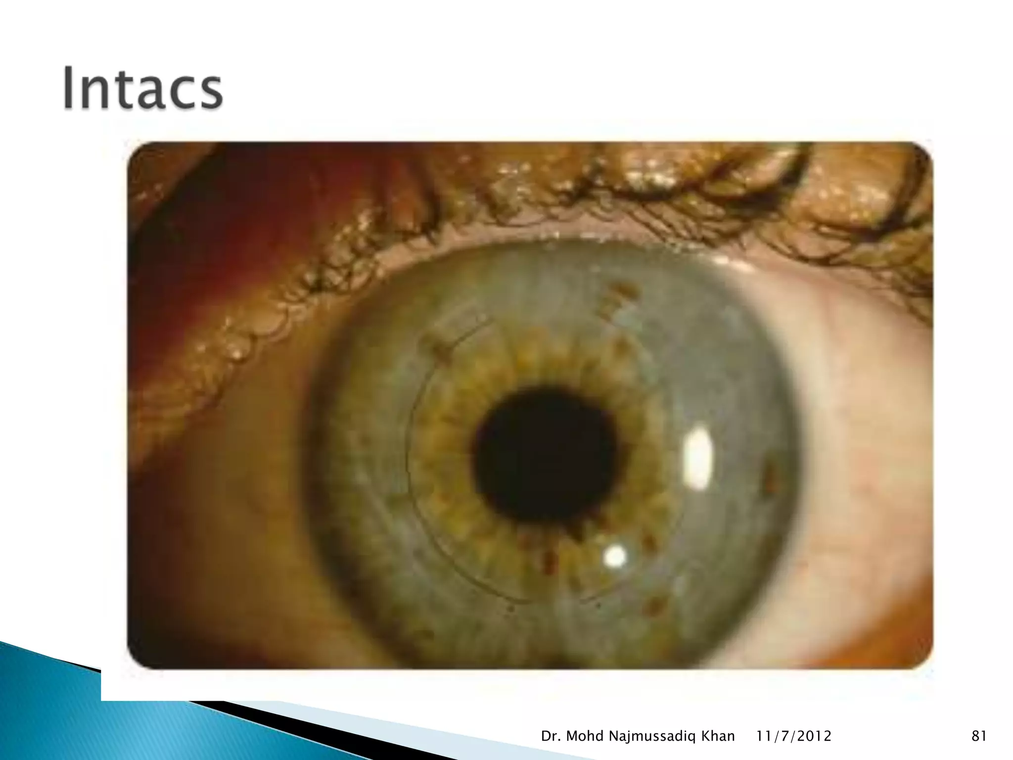 Dr. Mohd Najmussadiq Khan   11/7/2012   81
 