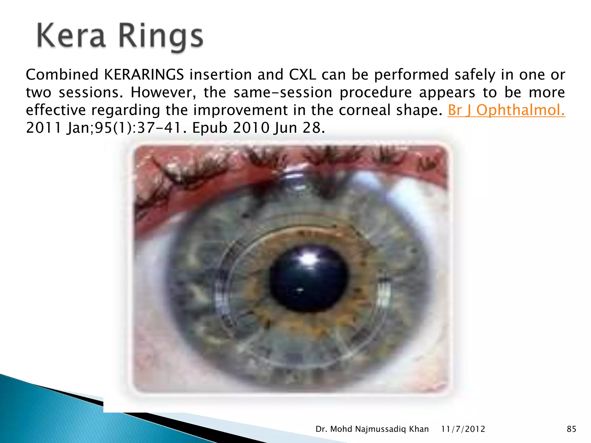Combined KERARINGS insertion and CXL can be performed safely in one or
two sessions. However, the same-session procedure appears to be more
effective regarding the improvement in the corneal shape. Br J Ophthalmol.
2011 Jan;95(1):37-41. Epub 2010 Jun 28.




                                       Dr. Mohd Najmussadiq Khan   11/7/2012   85
 