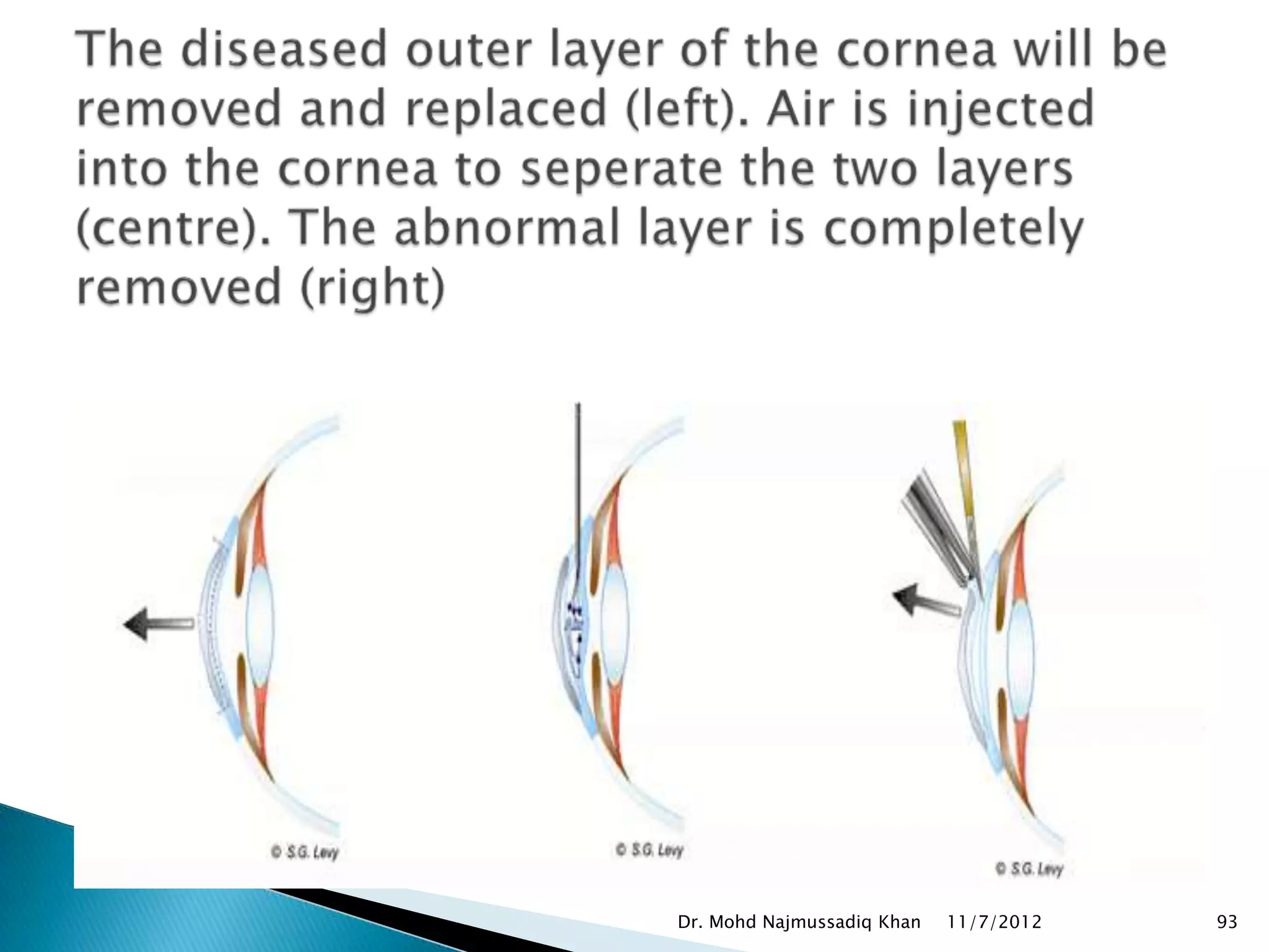 Dr. Mohd Najmussadiq Khan   11/7/2012   93
 