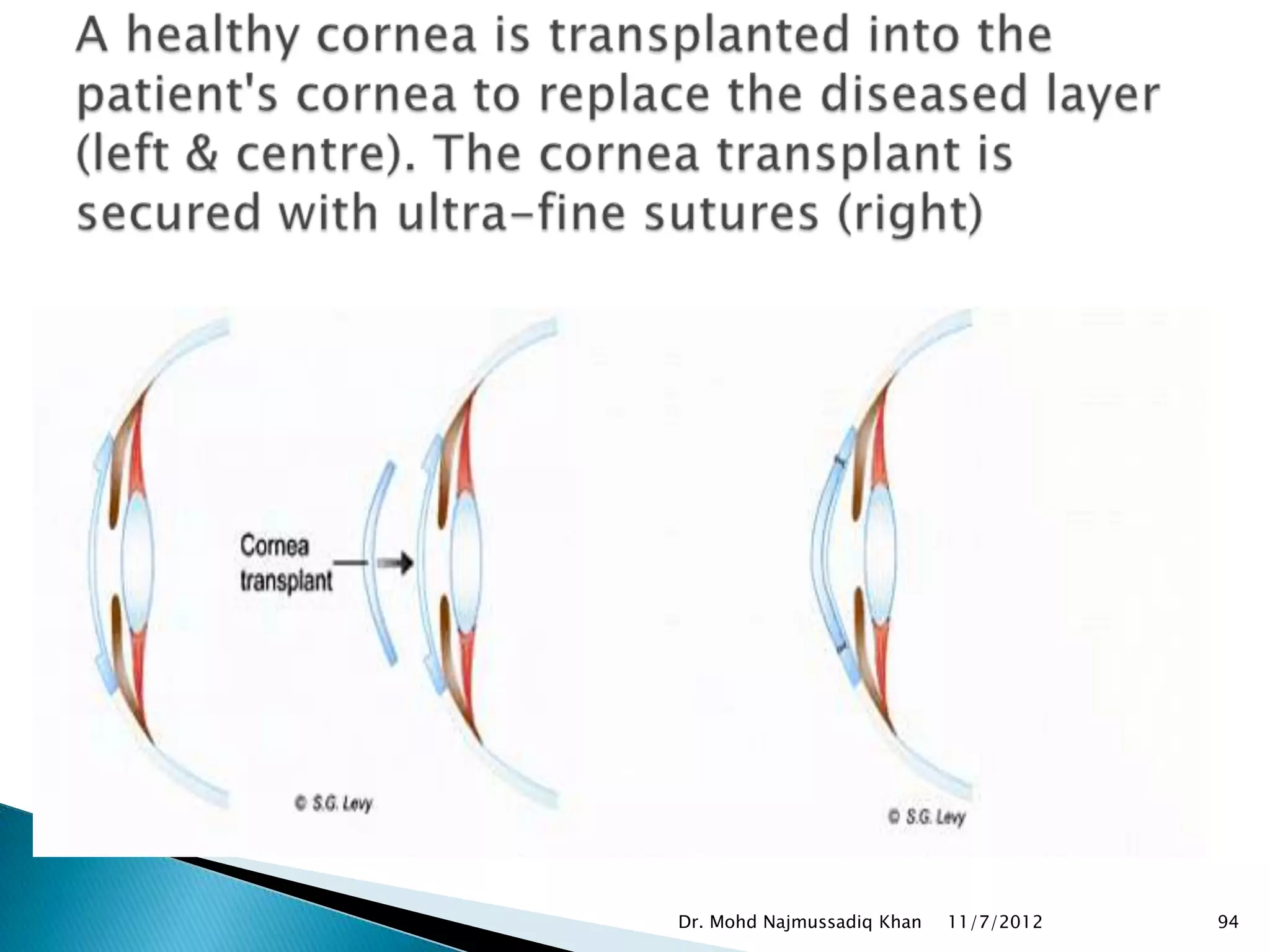 Dr. Mohd Najmussadiq Khan   11/7/2012   94
 