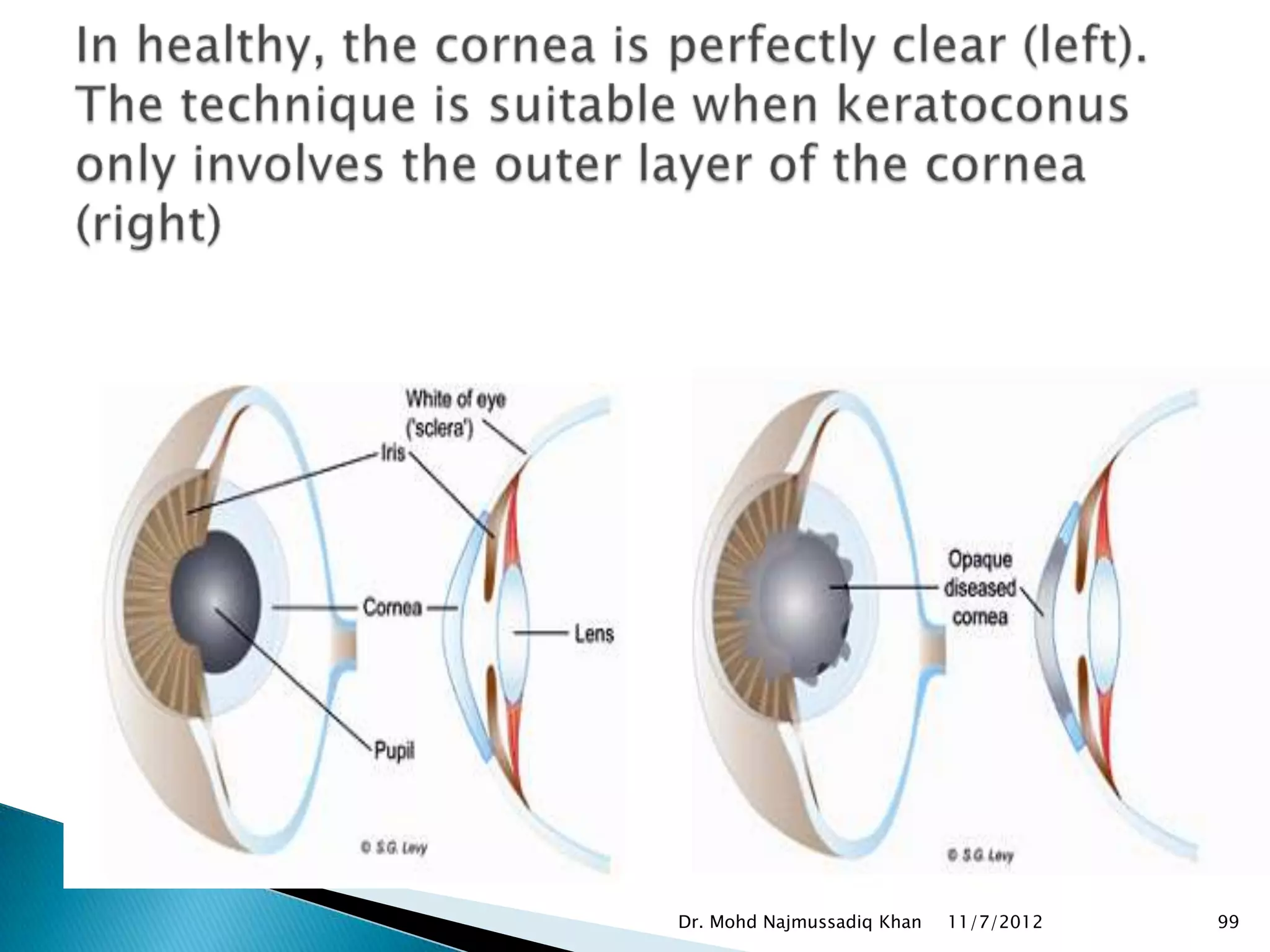 Dr. Mohd Najmussadiq Khan   11/7/2012   99
 