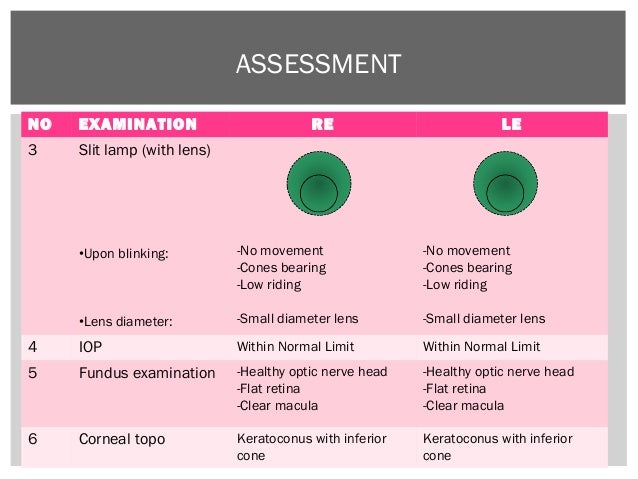 Sharingan contact lenses picture
