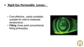 Rigid Gas Permeable Lenses -
• Cost effective , easily available ,
suitable for mild to moderate
keratoconus .
• Fitting: three point conventional
fitting philosophy.
 