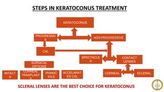 STEPS IN KERATOCONUS TREATMENT
KERATOCONUS
PROGRESSIV
E
NON PROGRESSIVE
SPECTACLE
S
CONTACT
LENSES
CXL
CORNEAL SCLERAL
INTACT
S
CORNEAL
TRASPLANT
S
PHAKIC
IOLS
ACCELARAT
ED CXL
SURGICAL
OPTIONS
SCLERAL LENSES ARE THE BEST CHOICE FOR KERATOCONUS
 