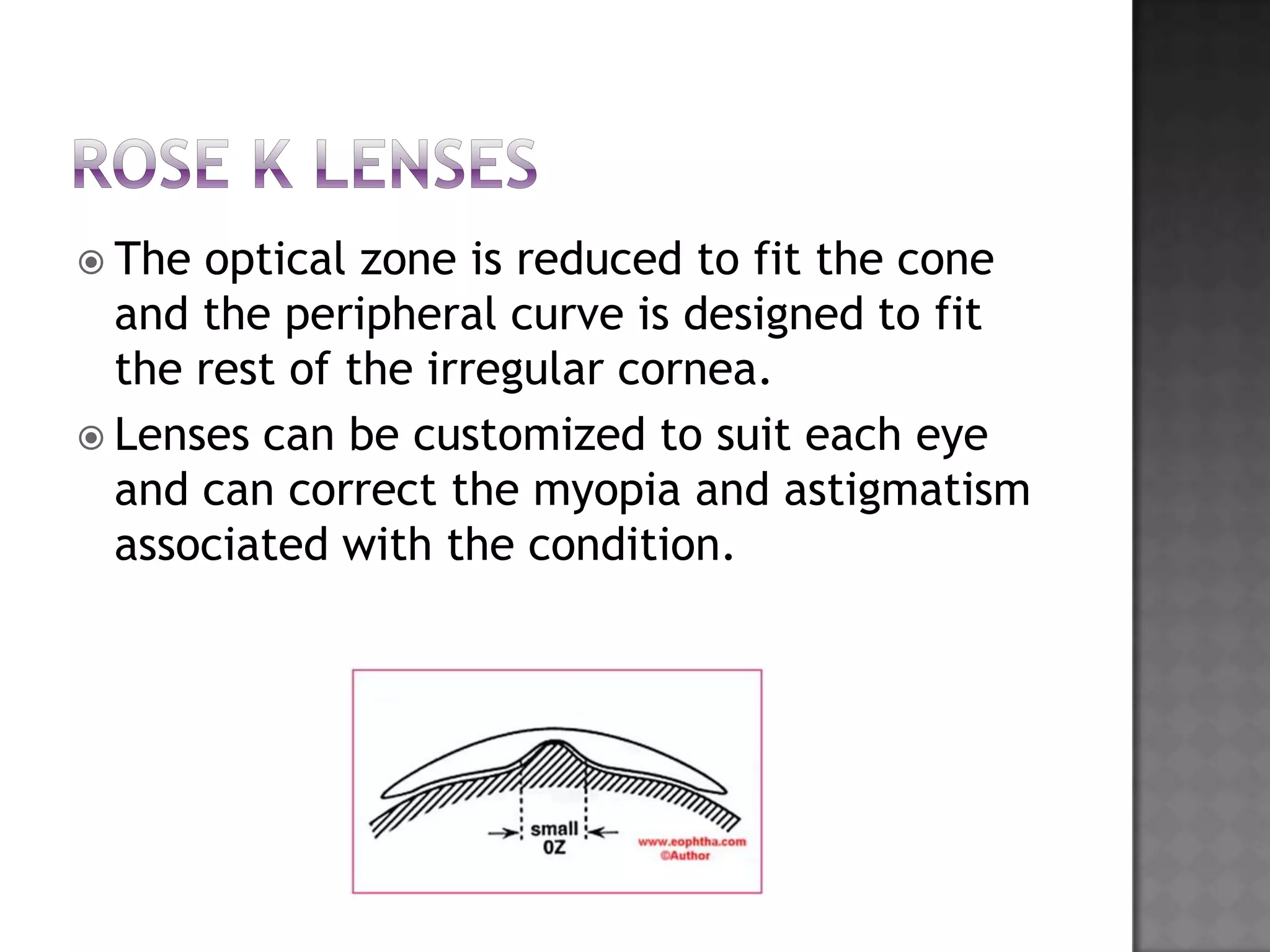  The optical zone is reduced to fit the cone
and the peripheral curve is designed to fit
the rest of the irregular cornea.
 Lenses can be customized to suit each eye
and can correct the myopia and astigmatism
associated with the condition.
 