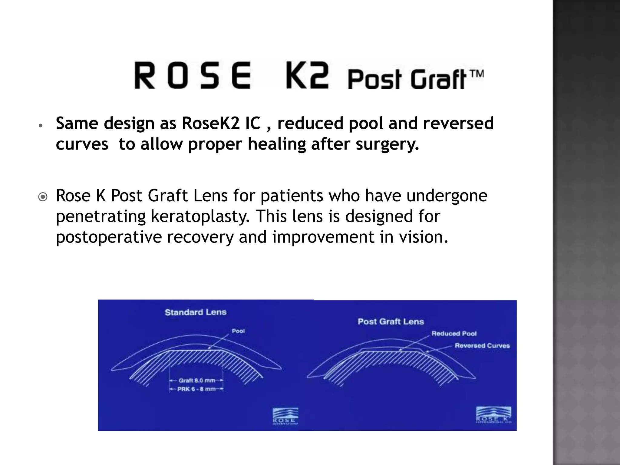 • Same design as RoseK2 IC , reduced pool and reversed
curves to allow proper healing after surgery.
 Rose K Post Graft Lens for patients who have undergone
penetrating keratoplasty. This lens is designed for
postoperative recovery and improvement in vision.
 