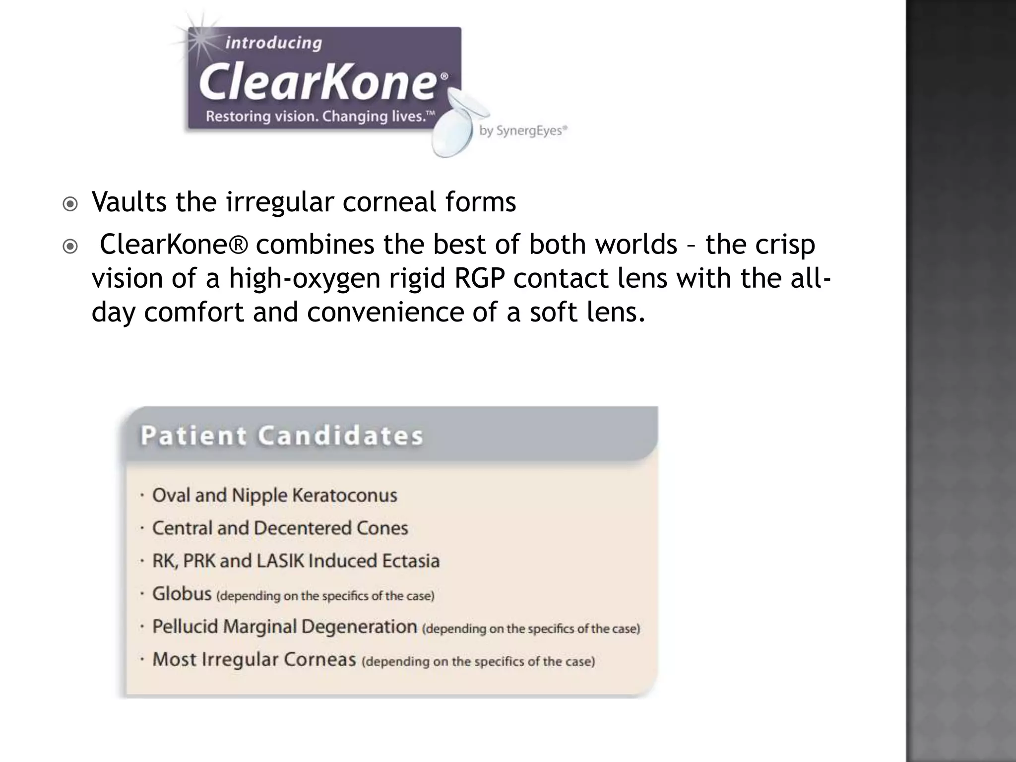  Vaults the irregular corneal forms
 ClearKone® combines the best of both worlds – the crisp
vision of a high-oxygen rigid RGP contact lens with the all-
day comfort and convenience of a soft lens.
 